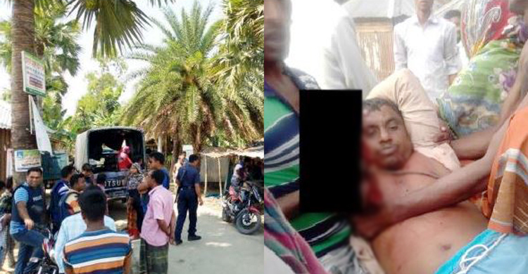 কৃষকের হাত কেটে নিয়ে গেল তারা