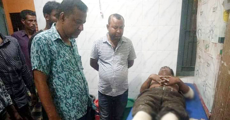 যুবলীগ নেতার হাত-পা ও দাঁত ভেঙে দিয়েছে দুর্বৃত্তরা