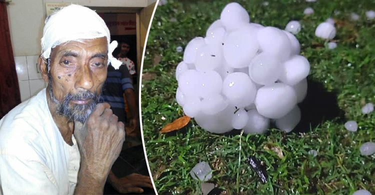 হাফ কেজি ওজনের শিল পড়লো বৃদ্ধের মাথায়