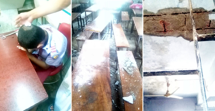 বিদ্যালয়ের ছাদের প্লাস্টার পড়ে মাথা ফাটল শিক্ষার্থীর