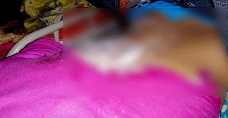 জমি নিয়ে বিরোধ : এসিডে কিশোরীর শরীর ঝলসে দিল প্রতিপক্ষ