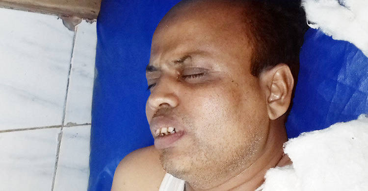 স্বতন্ত্র প্রার্থীর পক্ষ নেয়ায় ইউপি চেয়ারম্যানকে কুপিয়ে জখম