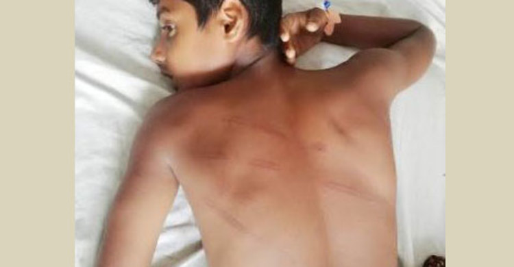 হুজুরের বেত্রাঘাতে হাসপাতালে মাদরাসার ছাত্র