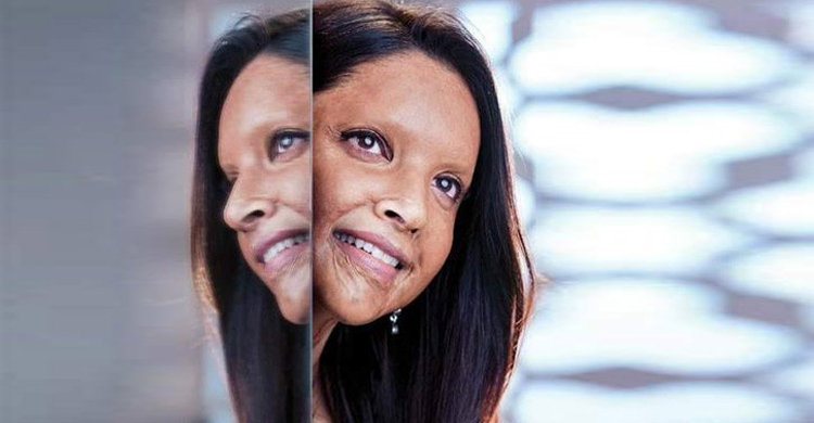 এসিডে ঝলসানো দীপিকার মুখ!