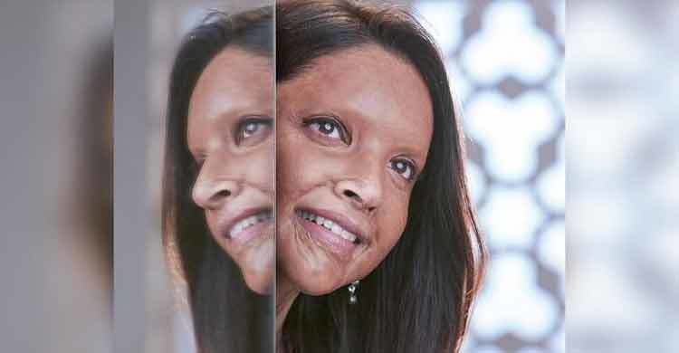 Deepika transforms into acid attack survivor Laxmi