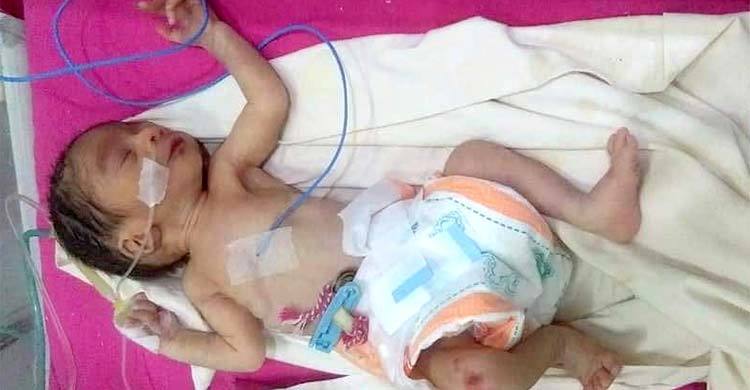 ড্রেনে পাওয়া নবজাতককে পাঠানো হলো ঢাকায়