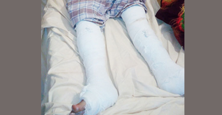 আ.লীগ নেতার দুই পা ভেঙে দিল তারা