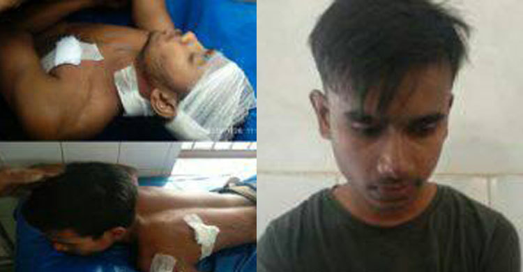 দিরাইয়ে সহপাঠীর ছুরিকাঘাতে দুই কলেজছাত্র আহত