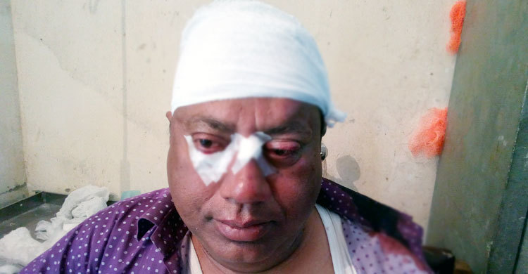 পুলিশের সামনেই আ.লীগ নেতাকে পিটিয়ে রক্তাক্ত