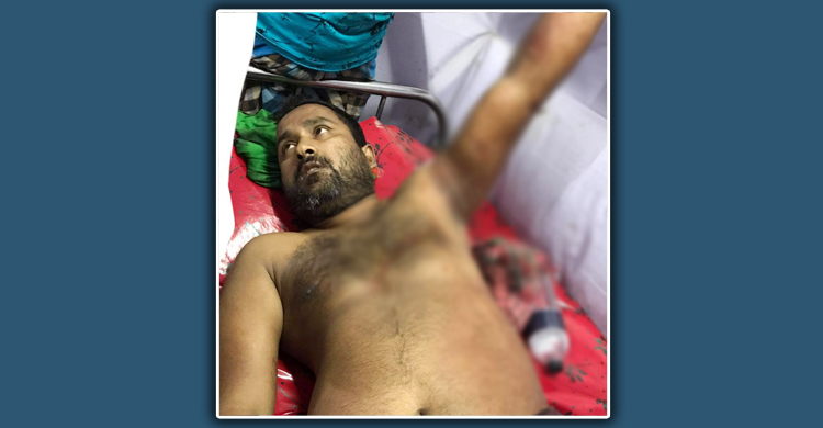 সাফারি পার্কে বাঘের থাবায় কর্মচারী আহত