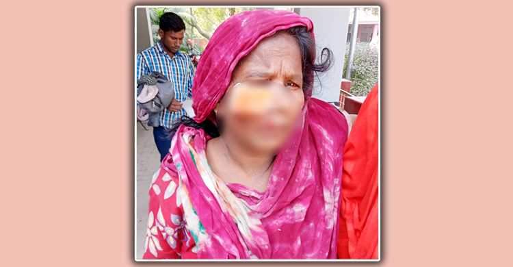 নাটোরে শিয়ালের কামড়ে আহত ৩