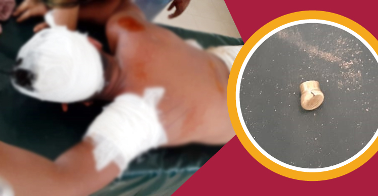 চাঁদা না দেয়ায় যুবকের বাড়িতে ‘খালাশী বাহিনীর’ হামলা, গুলিবিদ্ধ