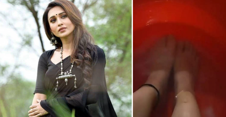 পা ফুলেছে মিমির