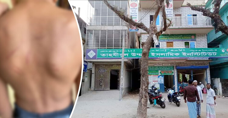মায়ের সামনেই চাবুক মেরে শিশুকে মাদরাসায় নিয়ে গেলেন শিক্ষক!