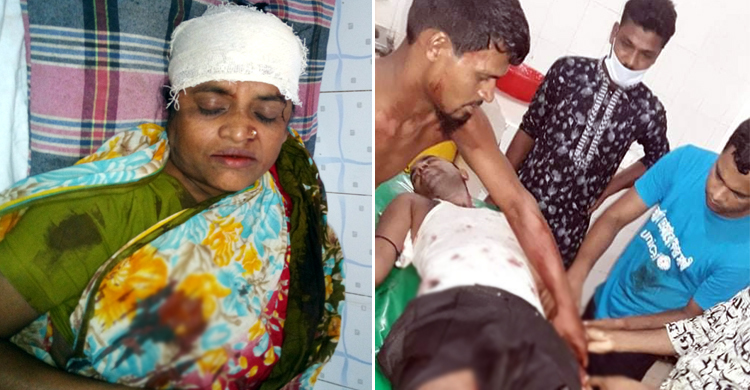স্বেচ্ছাসেবক লীগ নেতাকে কোপালেন যুবলীগ নেতা