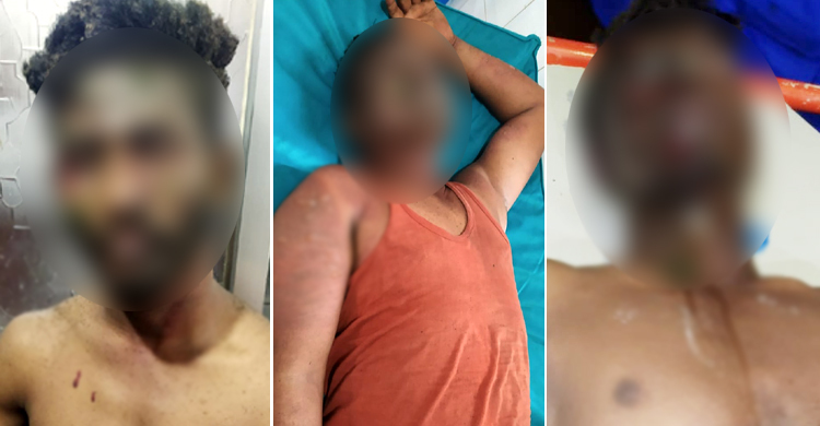 সীতাকুণ্ডে গ্যাস সিলিন্ডার বিস্ফোরণে দগ্ধ ৩