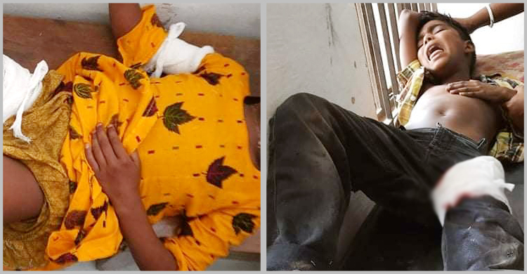 সাবেক এমপির বাড়ির পাশে ককটেল বিস্ফোরণ, দুই শিশু আহত