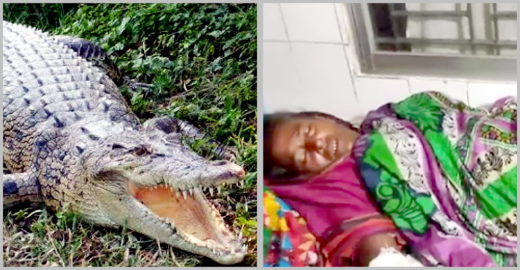ফরিদপুরে কুমিরের কামড়ে হাসপাতালে গৃহবধূ