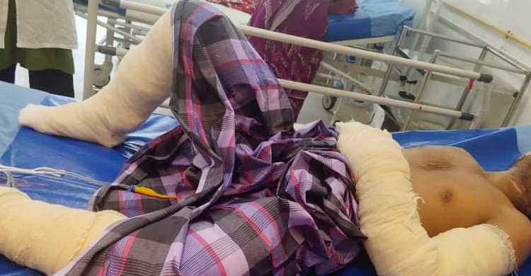 নারায়ণগঞ্জে পোশাক কারখানার গ্যাস লাইনে বিস্ফোরণ, দগ্ধ ৫