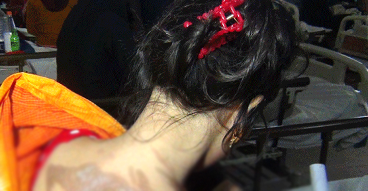 ফুটন্ত পানি দিয়ে স্ত্রীর শরীর ঝলসে দিলেন স্বামী