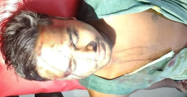 মাংস বণ্টনে অনিয়মের প্রতিবাদ করায় সাংবাদিকের ওপর হামলা