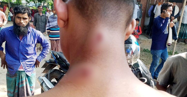 পরীক্ষার ফি দিতে না পারায় মাদরাসাছাত্রকে পিটিয়ে জখম