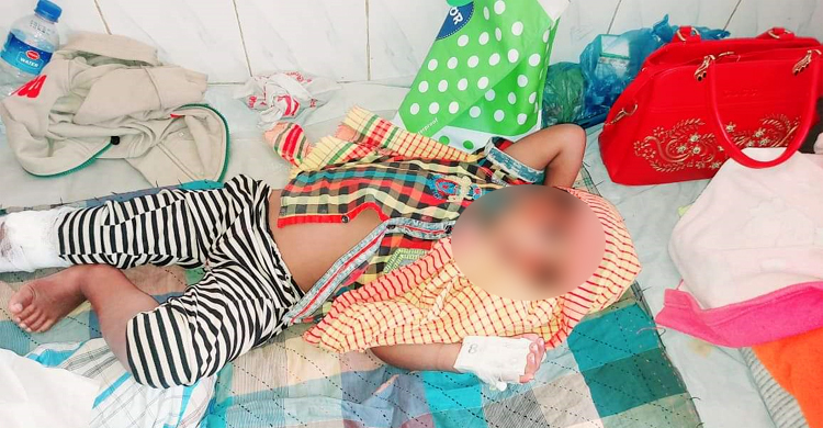 বরগুনায় কুকুরের কামড়ে নারী-শিশুসহ আহত ৩০