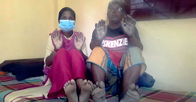 হাত-পায়ের চামড়া ফেটে খসে পড়ছে বাবা-মেয়ের