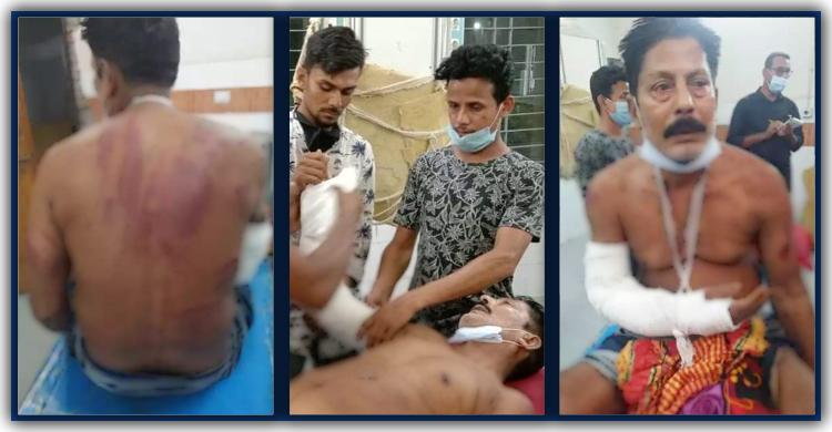 বৃদ্ধ বাবাকে মেরে হাত ভেঙে দিল দুই ছেলে