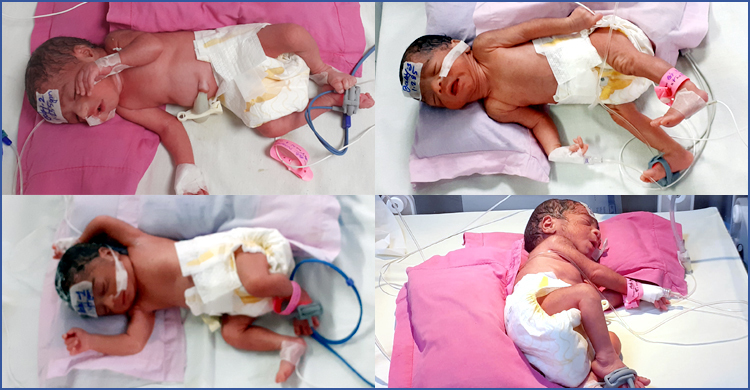 একসঙ্গে চার সন্তান জন্ম দিলেন প্রবাসীর স্ত্রী