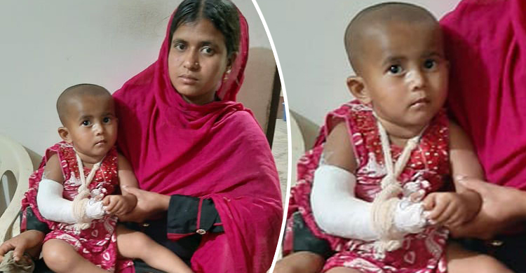 শিশুর ভাঙা হাত রেখে ভালো হাতে প্লাস্টার করলেন চিকিৎসক