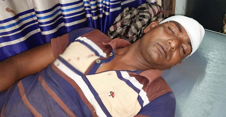 রমজানে প্রকাশ্যে ধূমপান, নিষেধ করায় মাথা ফাটালেন যুবক