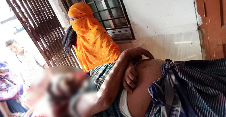 মসজিদে সংঘর্ষে জড়ালো দুই মেম্বার প্রার্থীর সমর্থকরা, আহত ২৫