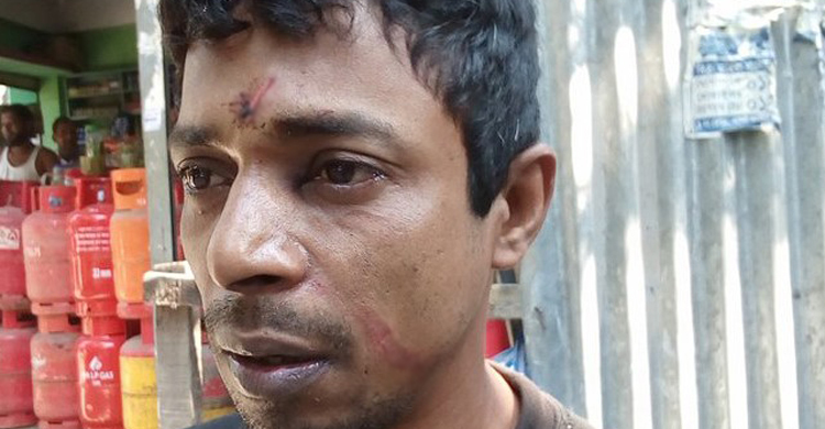 প্রেমিকার জন্য ইলেক্ট্রিশিয়ানকে পেটালেন আ.লীগ নেতা