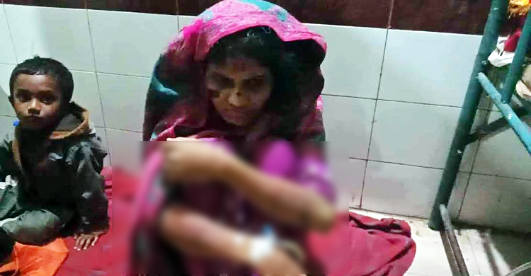 ‘মামলা তুলে না নেয়ায়’ গৃহবধূকে অমানবিক নির্যাতন!