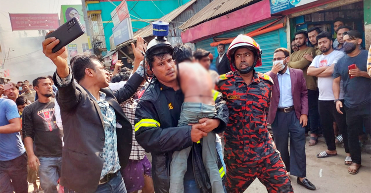 মারা গেলো অগ্নিদগ্ধ শিশু জাহিদুলও