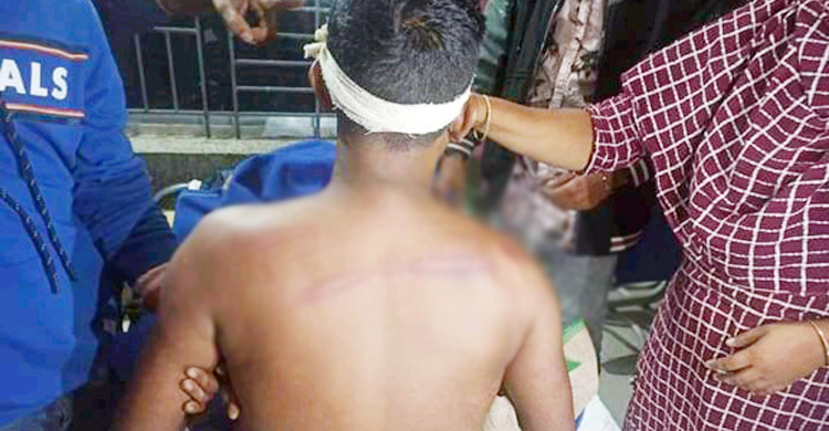 শার্শায় স্বতন্ত্র প্রার্থীর ৩ কর্মীকে কুপিয়ে জখম