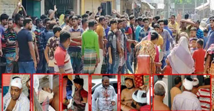 শার্শায় ইউপি নির্বাচনের প্রার্থিতা নিয়ে দু'পক্ষের সংঘর্ষে আহত ৫০