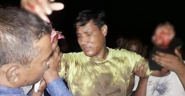 যশোরে সাবেক ইউপি সদস্যের ওপর বোমা নিক্ষেপ