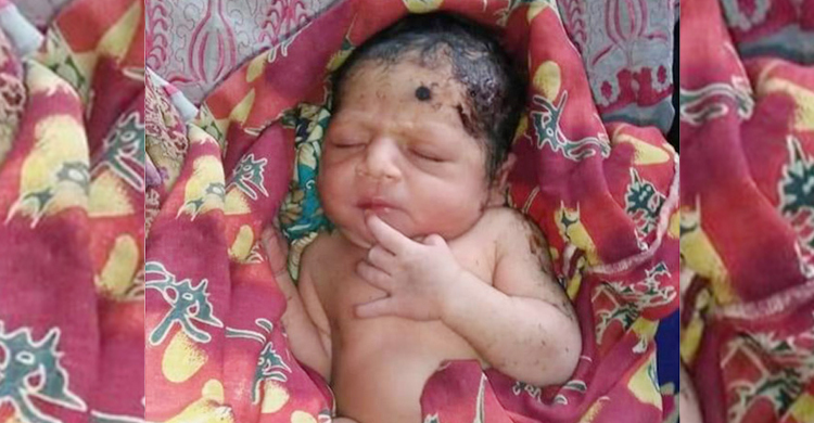 ক্ষেতের আইলে বস্তাবন্দি জীবিত নবজাতক