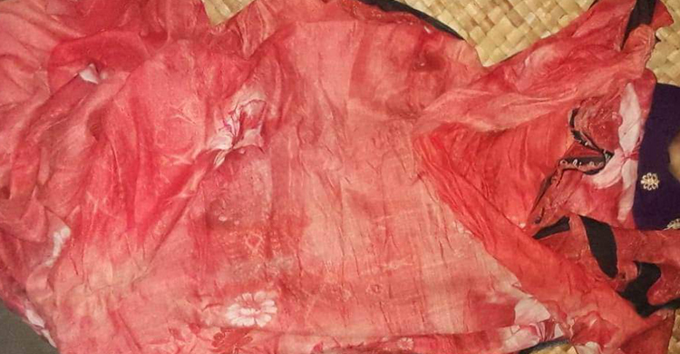 ভোলায় অটোরিকশাচাপায় শিশুর মৃত্যু