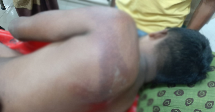 ভোলায় প্রেমঘটিত বিরোধের জেরে হাত-পা বেঁধে যুবককে নির্যাতন