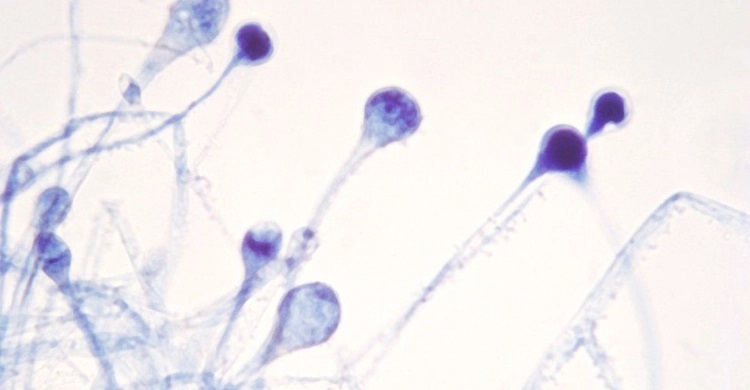 India reports nearly 9,000 'black fungus' cases