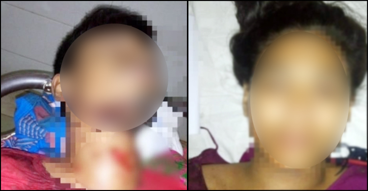 প্রেম করে বিয়ে, ঝগড়ায় একে অপরকে হত্যাচেষ্টা