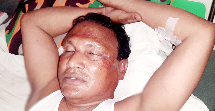 কমিটি নিয়ে শিক্ষকের সঙ্গে মারামারি, হাসপাতালে আ’লীগ নেতা