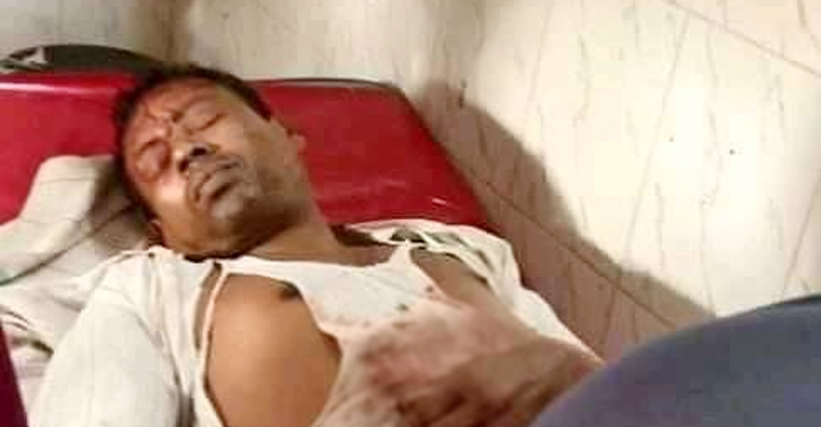 দুই পায়ের রগ কেটে দেয়া সেই শিক্ষকের মৃত্যু