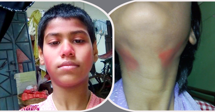 দিনে ২০-২৫ বার আশিকার শরীর দিয়ে রক্ত ঝরছে