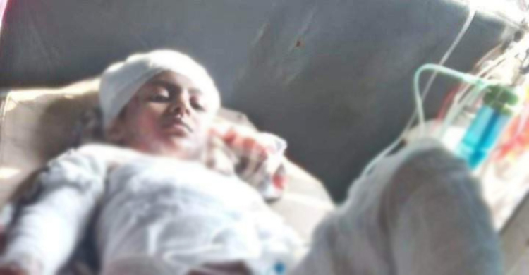 ১৪ ঘণ্টা পর আগুনে ঝলসে যাওয়া সেই শিশুর মৃত্যু