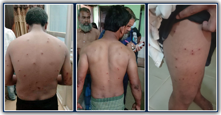 ব্রাহ্মণবাড়িয়ায় দু’পক্ষের সংঘর্ষ, পুলিশ-সাংবাদিকসহ আহত ৩০