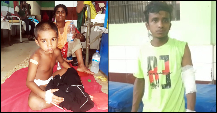 ব্রাহ্মণবাড়িয়ায় কুকুরের কামড়ে আহত ২৫